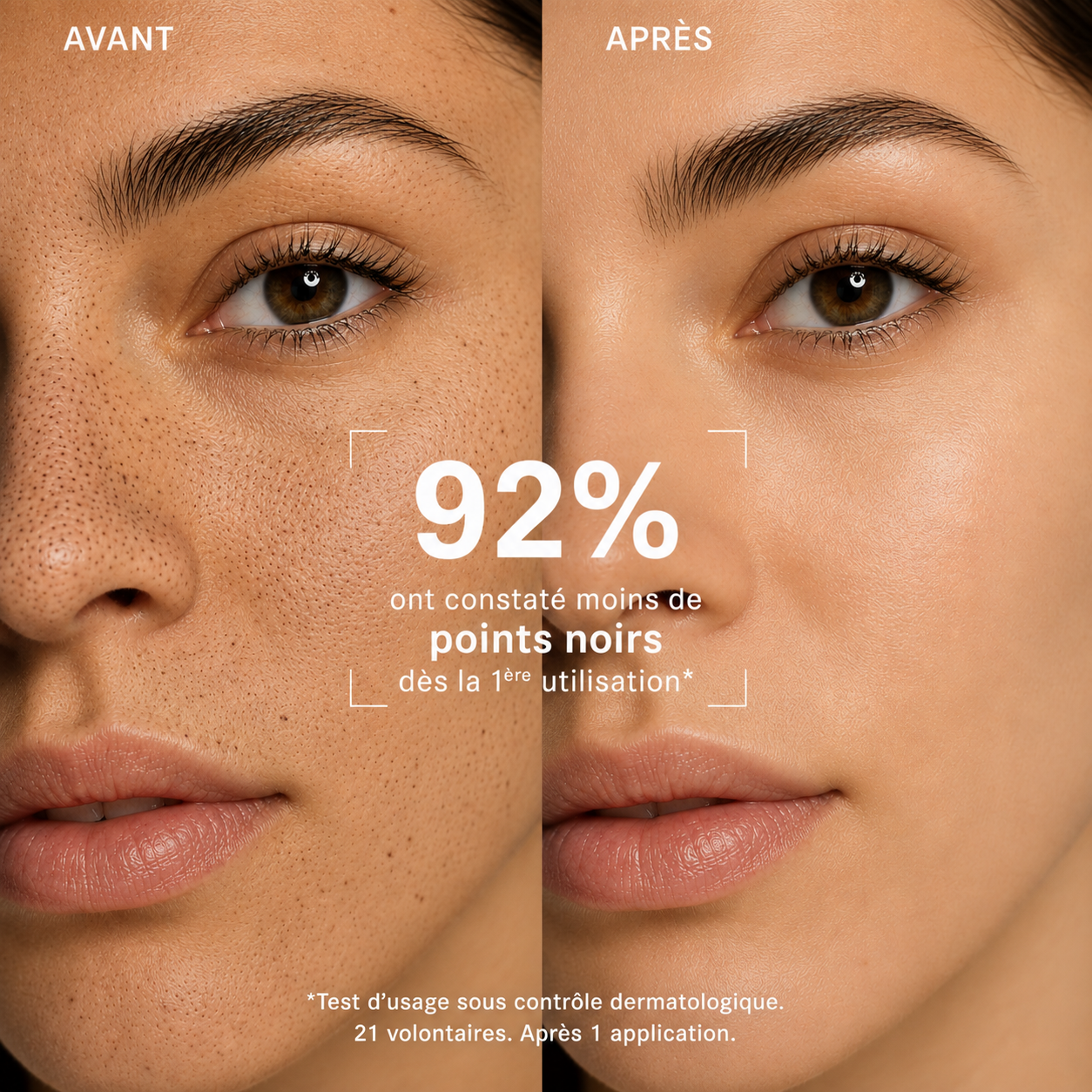 MASQUE ANTI-POINTS NOIRS
